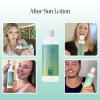 After Sun Lotion with Aloe Vera – Ultra Cooling Aloe Vera for Sunburn Hydration with Cocoa Butter & Rosehip Oil – Hydrating Aloe Lotion After Sun Moisturizer for Dry Skin with Hyaluronic Acid(Lotion)