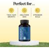 Biotin 10000mcg and Collagen Supplement – Hair Growth Supplement with Saw Palmetto for Women & Men – Horsetail Biotin Collagen Keratin and More DHT Blocker Hair Growth Vitamins for Women & Men 1 Month(60 Count (Pack of 1))