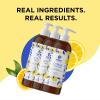 Lemon Verbena Hand Soap Liquid – Premium Aromatherapy Lemon hand soap with Tea Tree Oil and Vitamin E for Bathroom and Kitchen – Sulfate Free Gentle Cleansing Hand Wash Soap for Kids and Adults 3-Pack